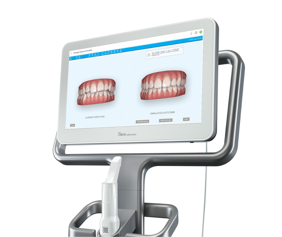 Benefícios do Invisalign Comparado aos Aparelhos Tradicionais. O Invisalign tem se destacado como uma alternativa eficaz e agradável.